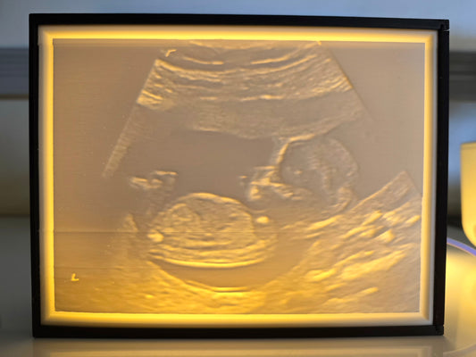 Custom 3D Printed Lithophane Lightbox Keepsake – Memorial, Wedding, Baby or Pet Photo - Light not included